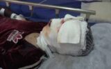 انفجار موادمحترقه مادر و پسری را راهی بیمارستان کرد