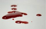 تخلیه چشم کودک که در  تماشای نزاع خیابانی بود