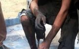 انفجار مواد محترقه در دست نوجوان 16ساله