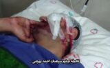 افسر پلیس از حکم قصاص ضارب خود گذشت