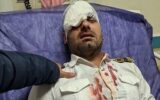 نابینا شدن پرسنل بیمارستان مسجدسلیمان